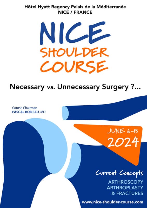 Nice Shoulder Course